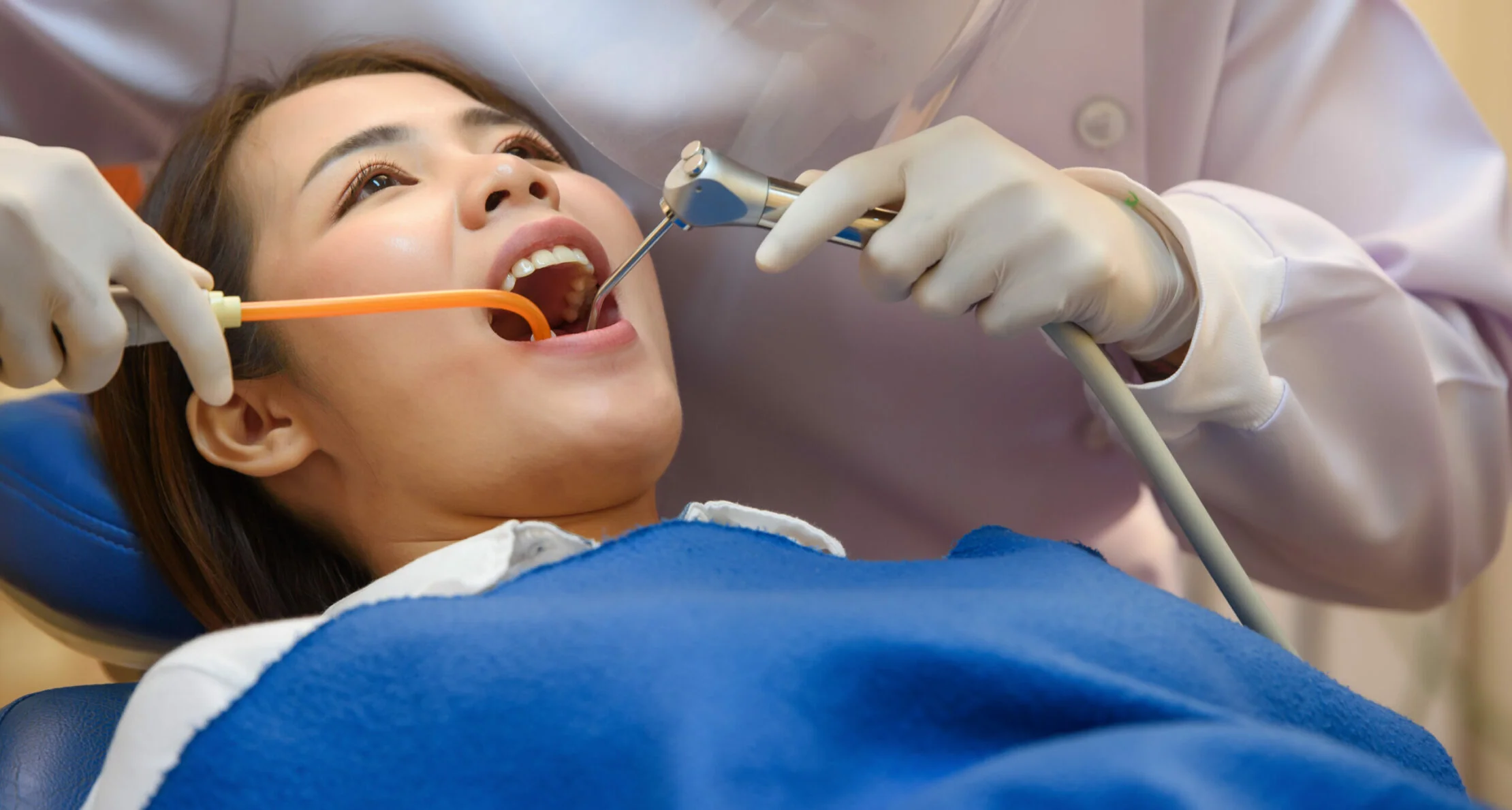 Typical cost of dental procedures offered by a local dentist